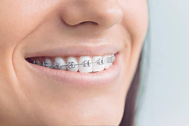 Best Invisalign and Clear Aligners  in Niceville, FL